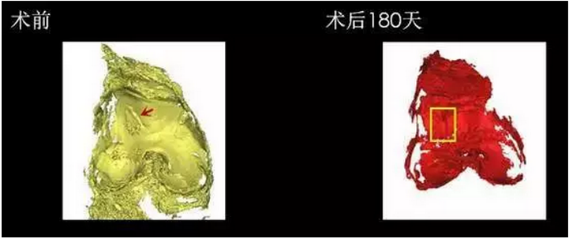 blob.png